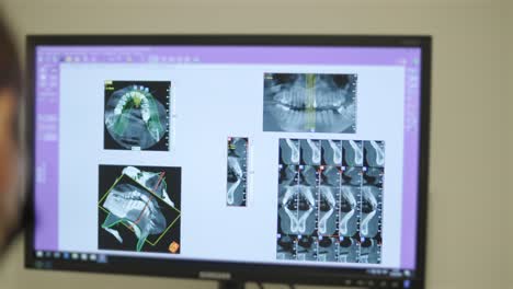 patient undergoing dental x-ray with technician