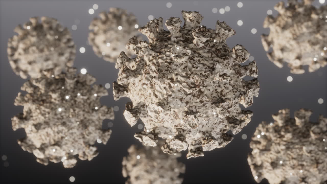 심각한 급성 호흡기 코로나-19의 현실적인 영상