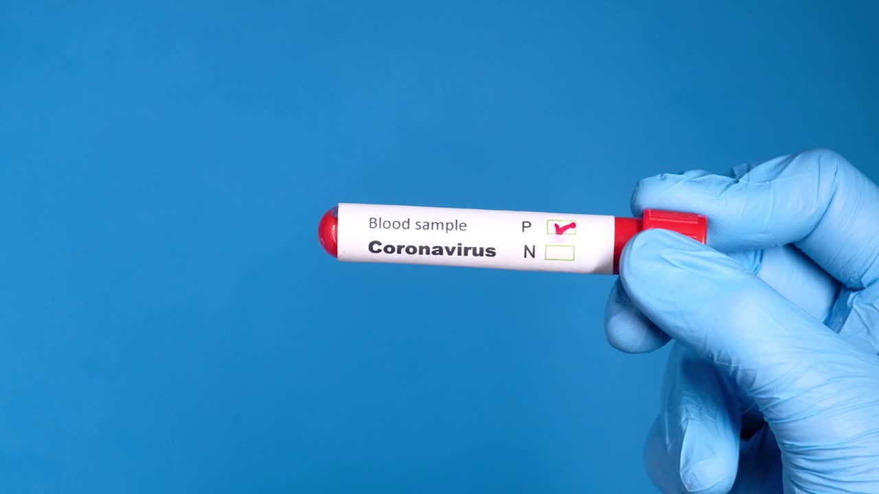 Teste Sanguíneo de Coronavírus