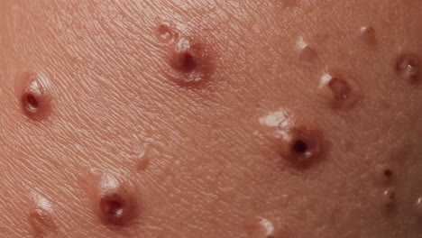 close-up of human skin with pores and blemishes