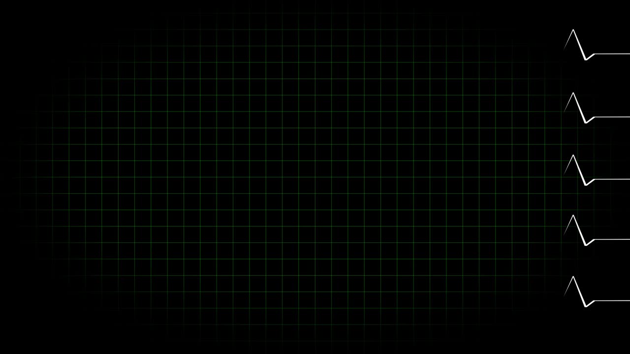 electrocardiograma osciloscopio forma de onda animación gráficos de movimiento