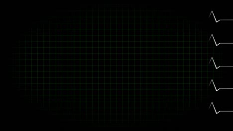 electrocardiograma osciloscopio forma de onda animación gráficos de movimiento