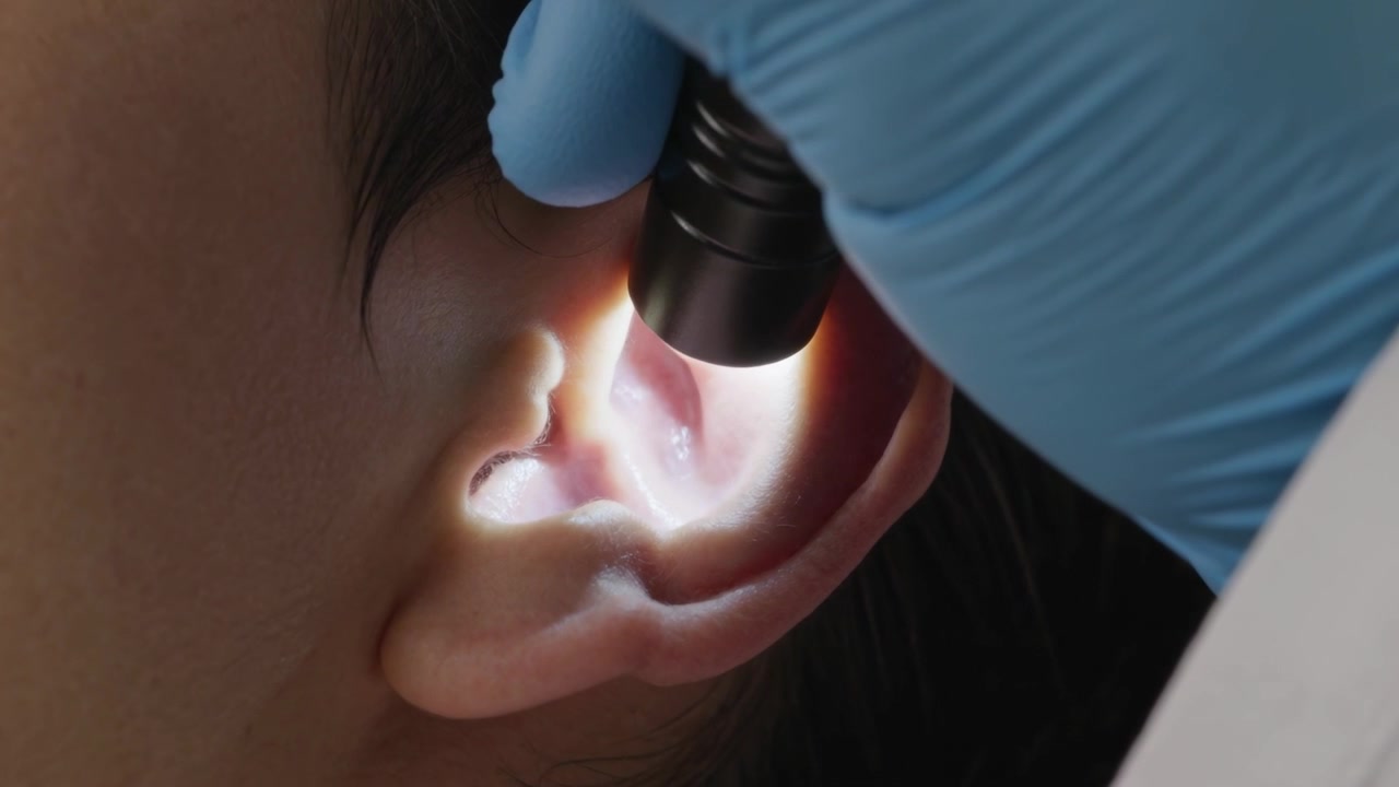 Con una penna luminosa, un medico con guanto blu ispeziona l'orecchio esterno in clinica, rivelando il condotto.