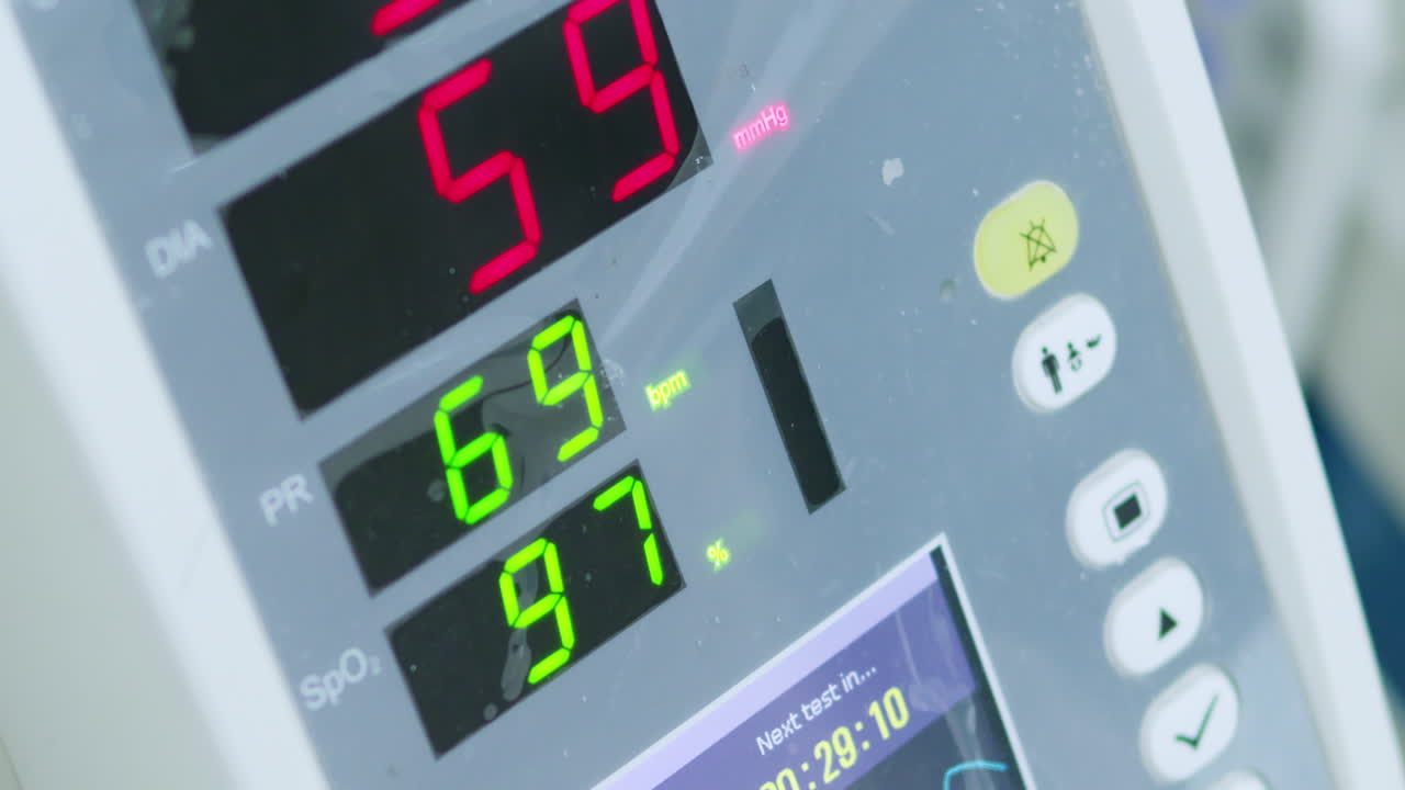 A close-up view of vital signs displayed a medical monitor in a hospital setting