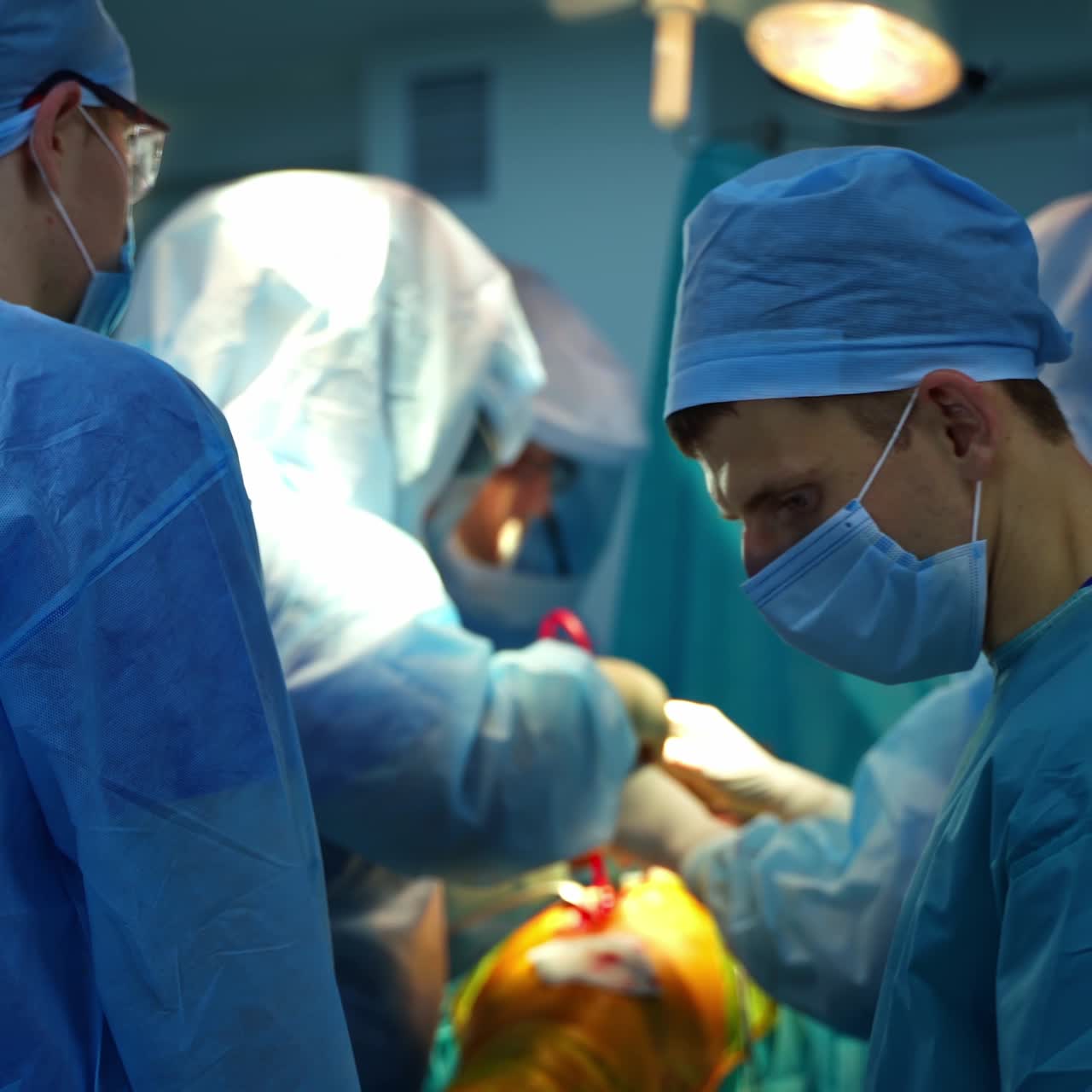 Medical specialists in the operating room. Patient on surgical table. Teamwork of doctors in blue protective uniform conduct a surgery to a patient.