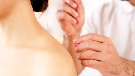 shoulder, acupuncture and hands of therapist