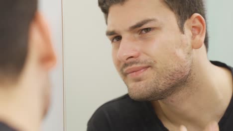 young man with pimples on his face is unhappy and angry.