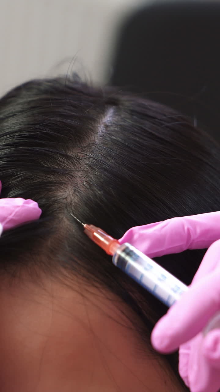 Woman receives an injection in the scalp. Problems of hair loss The concept of health. Vertical video