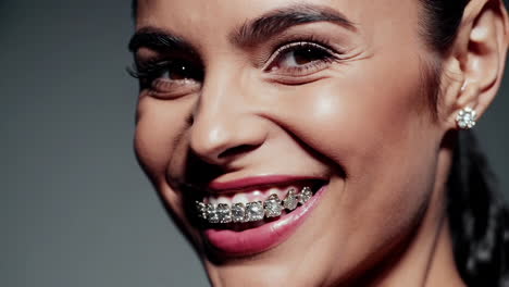 close-up of a smiling woman with diamond braces