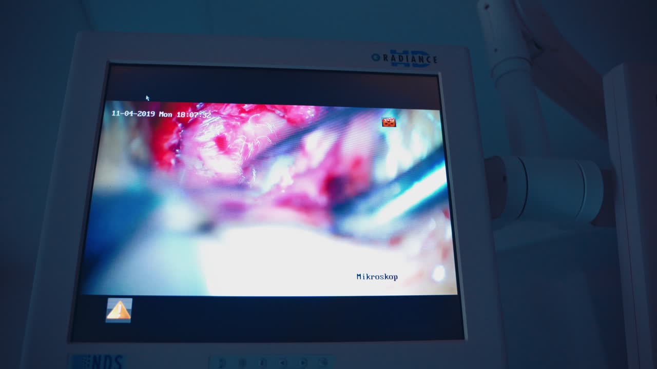 Monitor in hospital theater. Medical devices in modern operating room
