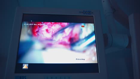 monitor in hospital theater. medical devices in modern operating room