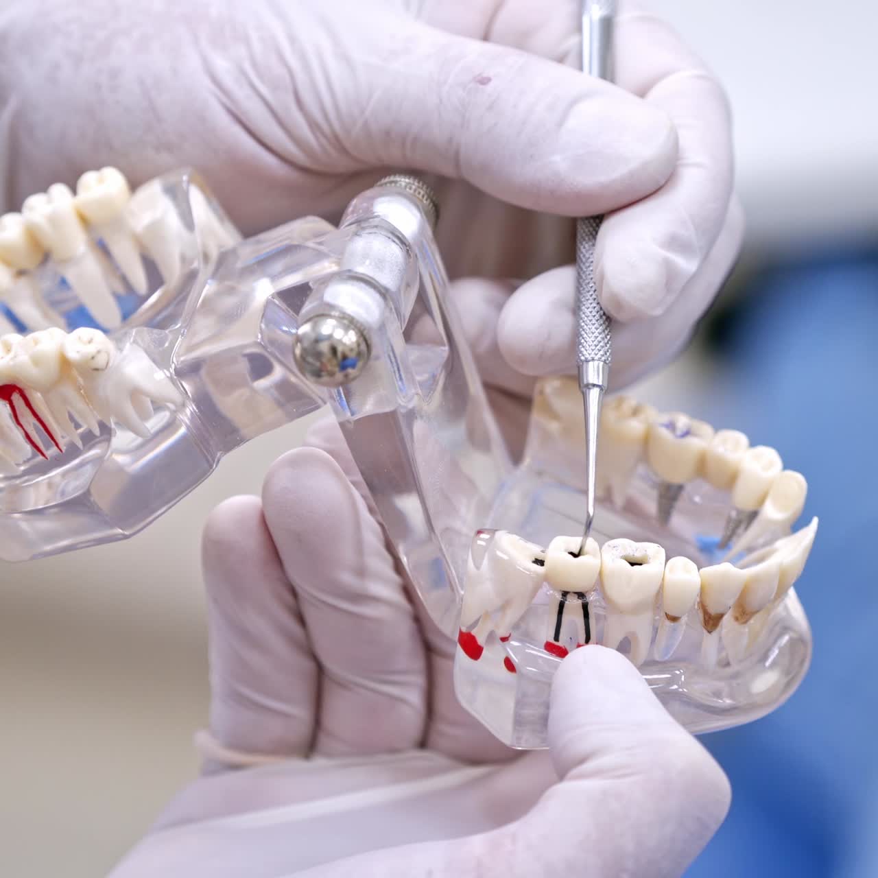 Teeth treatment and cure