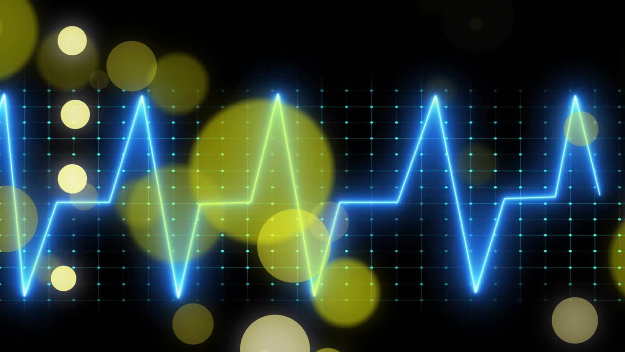 EKG-käyrä alkaa vasemmalta, piirtäen hiipuvia huippuja samalla kun kultaiset ympyrät leijuvat visualisoiden elintoimintoja.