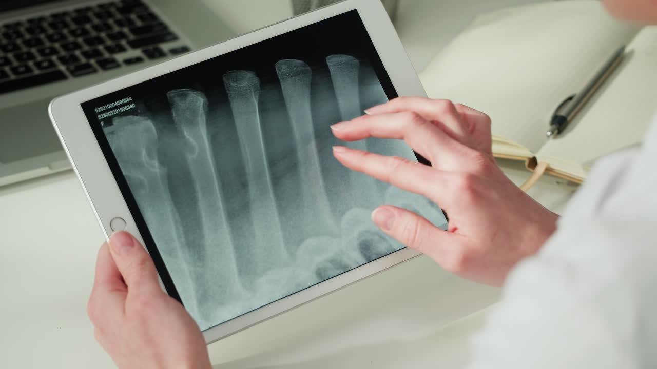 Doctor reviewing x-ray of arm or leg