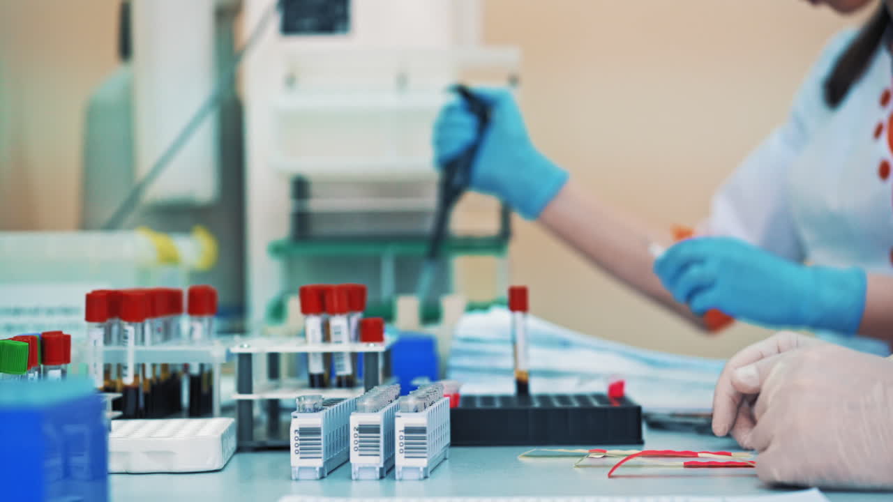 Medical workers put blood samples in tube onto a special rack in clinic. Women scientists in protective gloves are working in modern pharmaceutical laboratory.