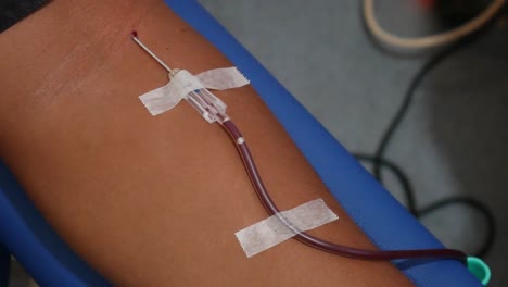 close up shoot of arm while donating blood at a transfusion center