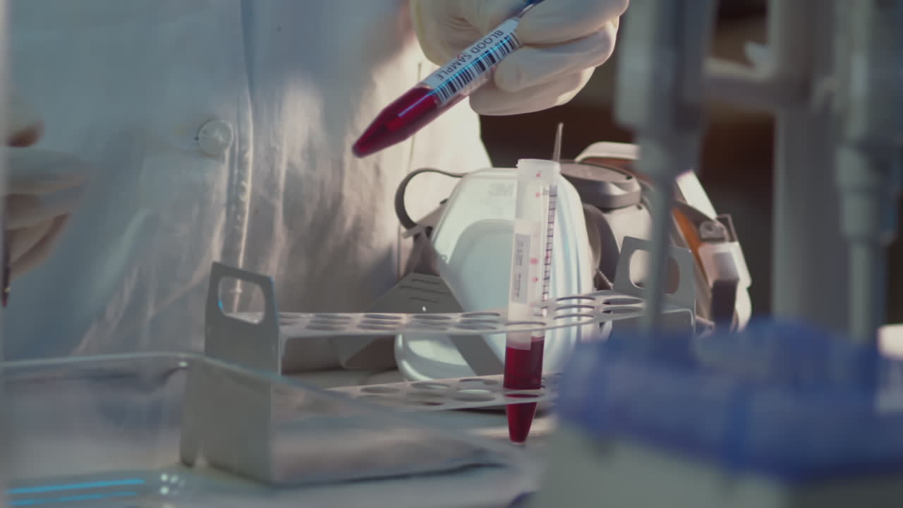 Laboratory scientist marking blood sample in test tube, closeup of hands in rubber gloves