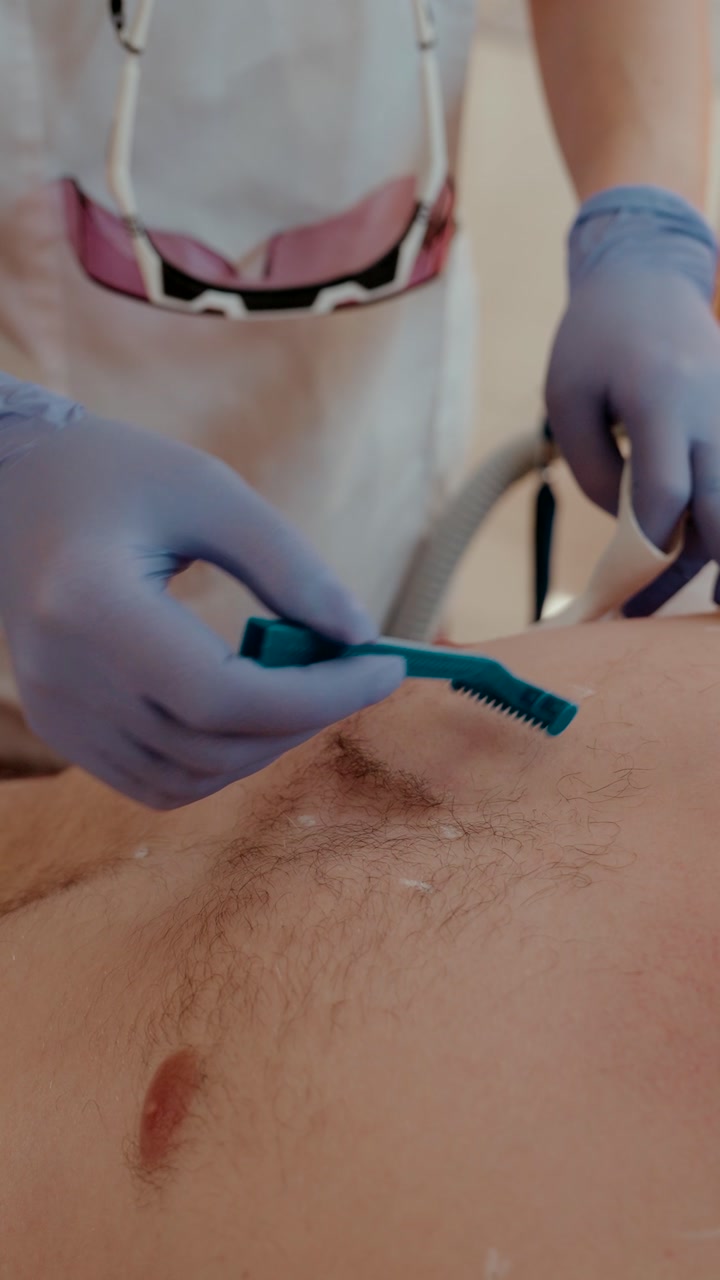gloved beauty technician using a disposable razor to shave male stomach hair prior to laser hair removal treatment at clinic