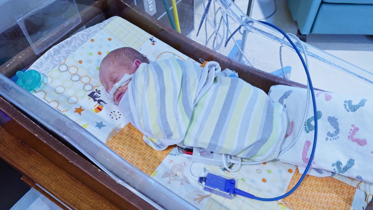 Neonato prematuro che dorme in una culla della TIN avvolto in una coperta a righe con cannula nasale e tubi blu dell'ossigeno visibili