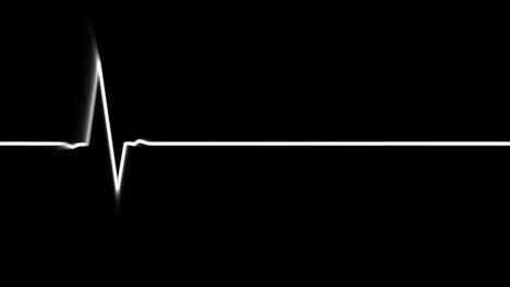 circuito de electrocardiograma