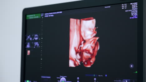 little unborn child's image on the ultrasound scan. checking the pregnancy progress in hospital.