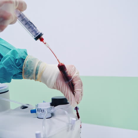 laboratory research of stem cells. platelet-rich plasma preparation. plasma in syringe.