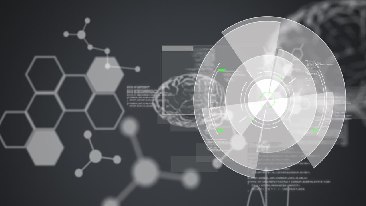 스 ⁇  스캐닝, 의료 데이터 처리 및 인간 뇌의 애니메이션