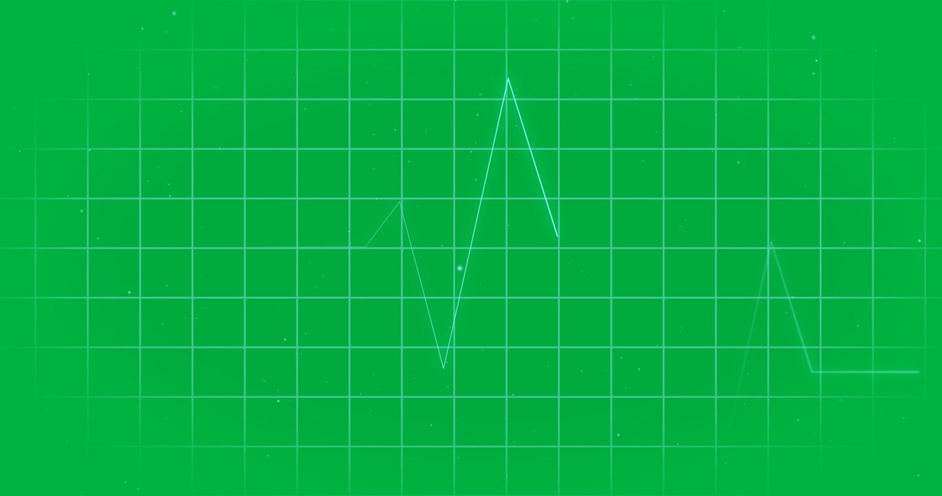 Animation of network of medical heart beat monitor data processing over transparent background