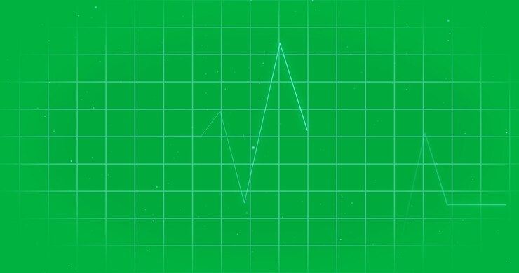 Animation of network of medical heart beat monitor data processing over transparent background
