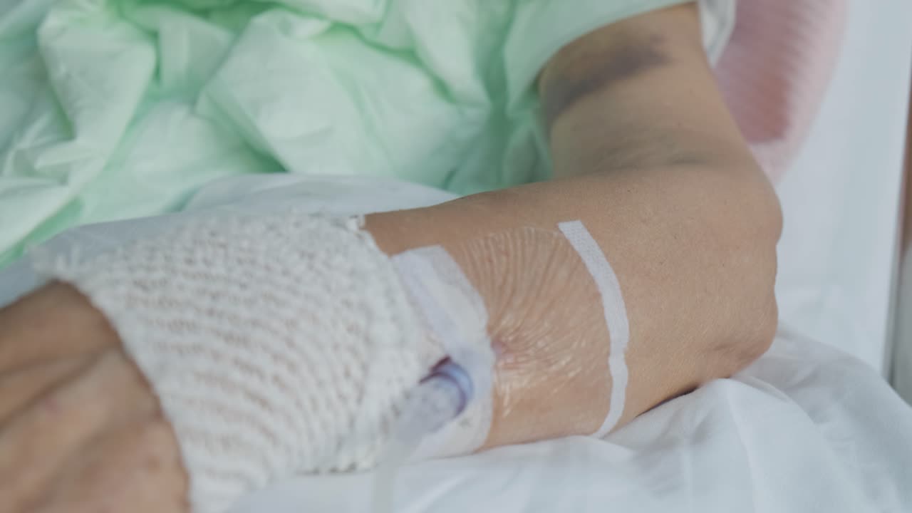 Movimento ravvicinato attraverso il letto d'ospedale di un paziente anziano, flebo e un braccio contuso.