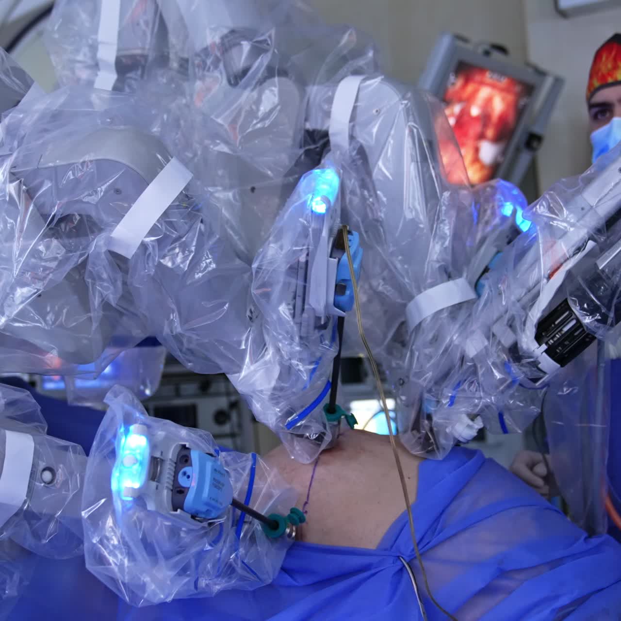 Minimal invasion surgery performed by the robot surgeon. Doctor standing behind arranging the tools. Procedure on the screen at backdrop