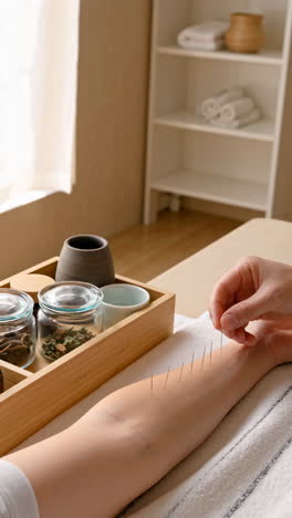 Acupuncture treatment session on a patient's arm