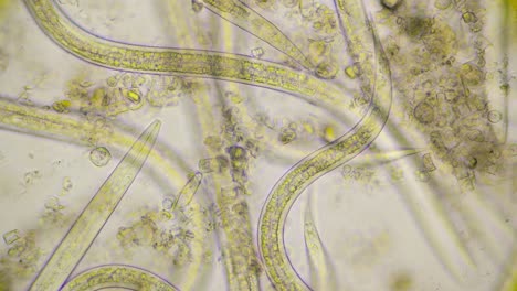 hermosa toma de fuertes gusanos redondos en movimiento, nematodos, bajo microscopio con 400 veces de ampliación