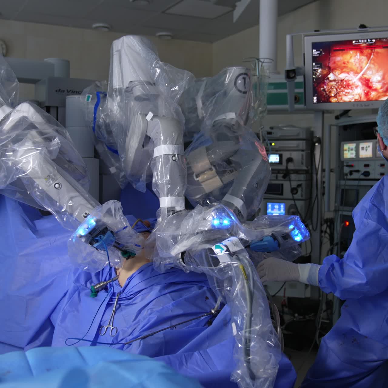 Male surgeon sits beside the working Da Vinci robot. Doctor watches how the endowrist instruments perform operation on the screen in surgery room