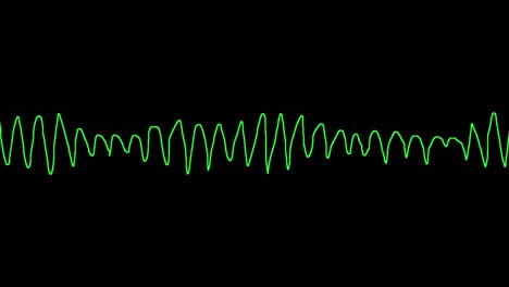 ecg shows torsades de pointes (tdp)