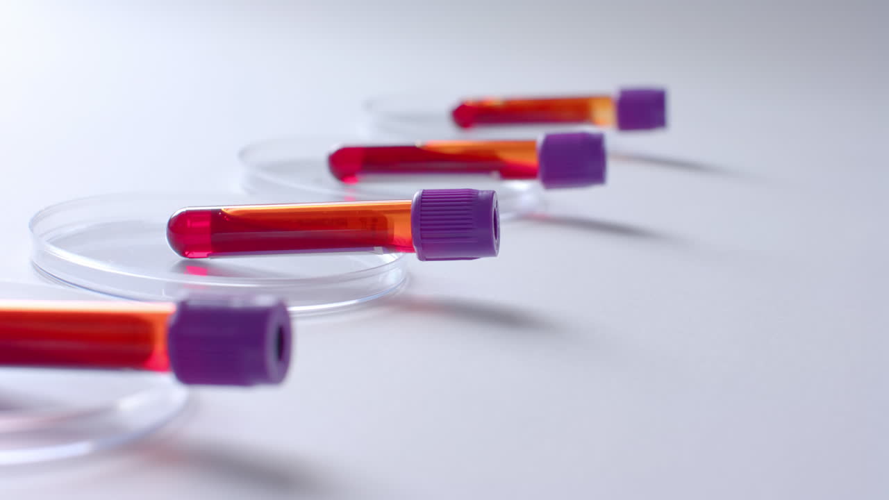 Close up of blood samples and petri dishes on white background, slow motion