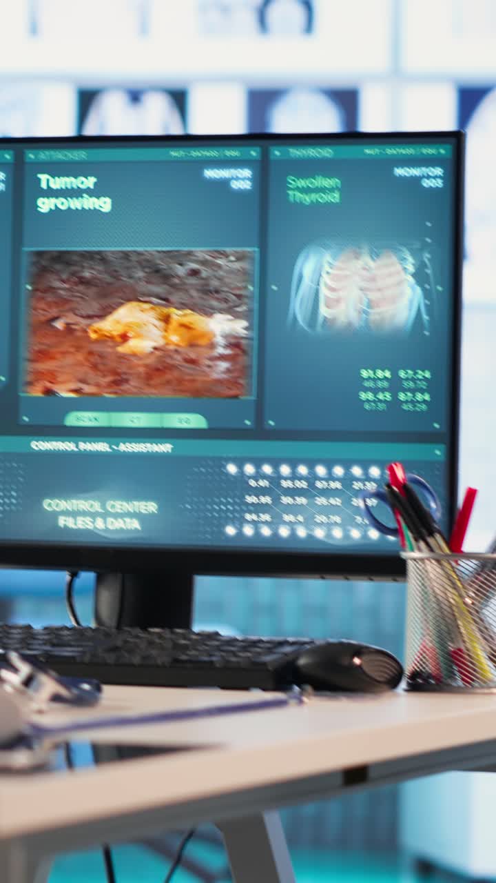 Medical Computer Monitor Showing Tumor and Thyroid Scan Results