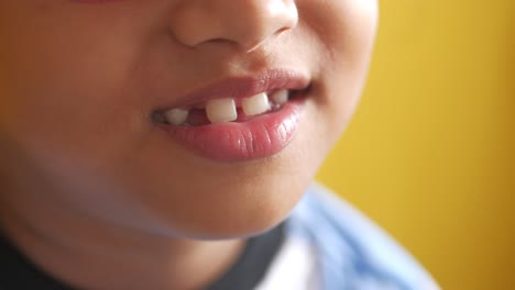 child smiling with teeth missing