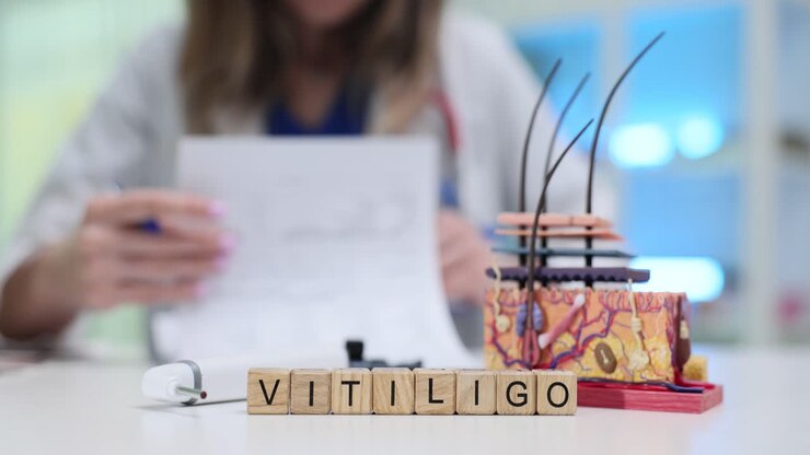 Medical Professional Reviewing Vitiligo Information with Skin Model
