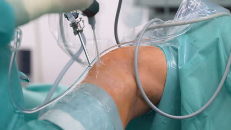 surgeon performing arthroscopic knee surgery - close-up