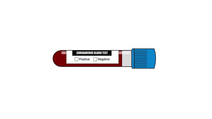 Negative Test Of Coronavirus Covid 19 Animation 2