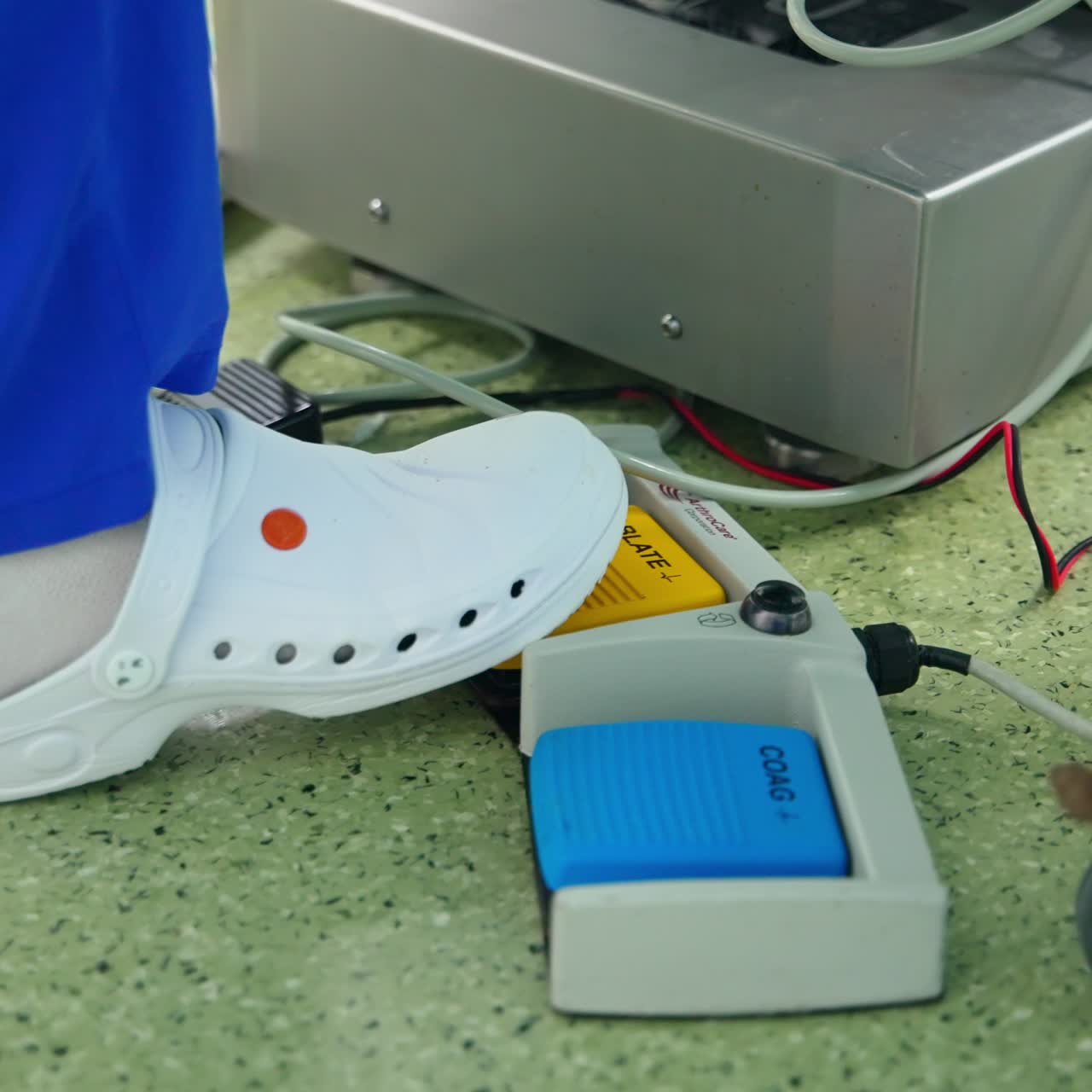 Doctor's foot in crocs presses blue and yellow pedals. Manipulating the equipment during surgery operation. Close up