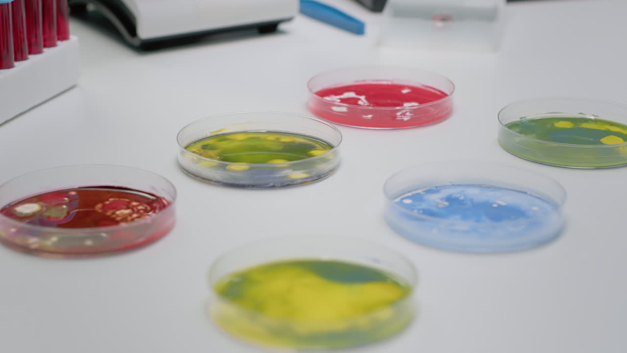 Petri dishes with bacterial cultures