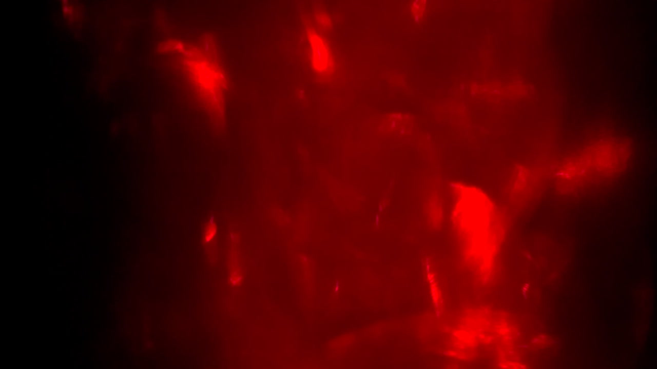 increíble brillo 04