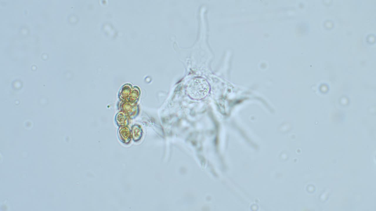 Slime mold amoeba in high magnification in motion