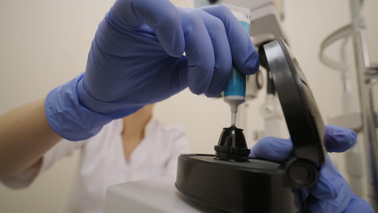 el cirujano oftalmólogo aplica el gel a la superficie de la lente de oftalmoscopía que se utiliza en oftalmología para el diagnóstico general de enfermedades oculares y específicamente para la trabeculoplastia láser selectiva.