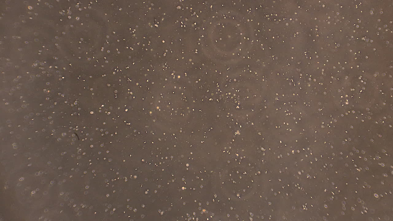 정액 속에 헤엄치는 정자 세포를 확대합니다.