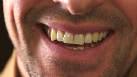 Primer-Plano-Oral-Del-Hombre-Riendo-Con-Dientes-Amarillos