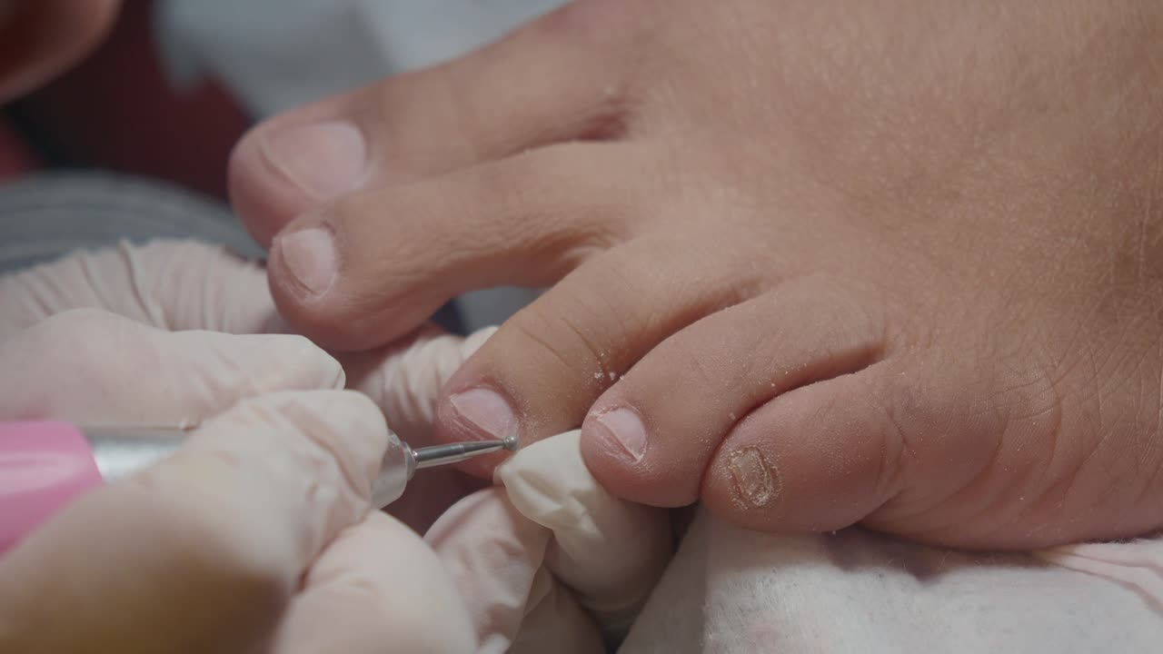 Trattamento professionale di pedicure con lima elettrica sulle unghie dei piedi