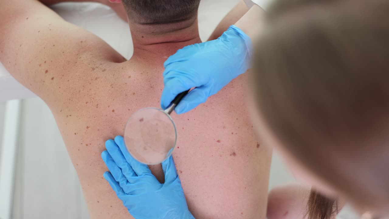 Dermatologist examining moles on a patient's back